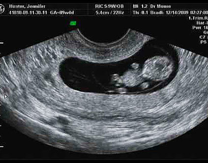 Фото эмбриона 38 недель